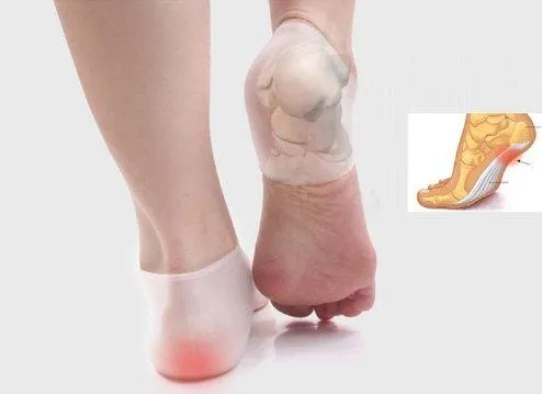 Heel Spur Relief -  Massage Gel Cup Pads for Plantar Fasciitis